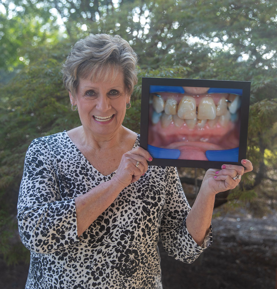 dental implant patient holding up before and after photo
